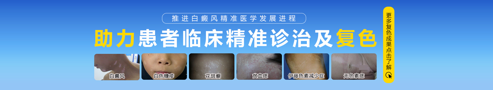 乌鲁木齐新军都白癜风医院